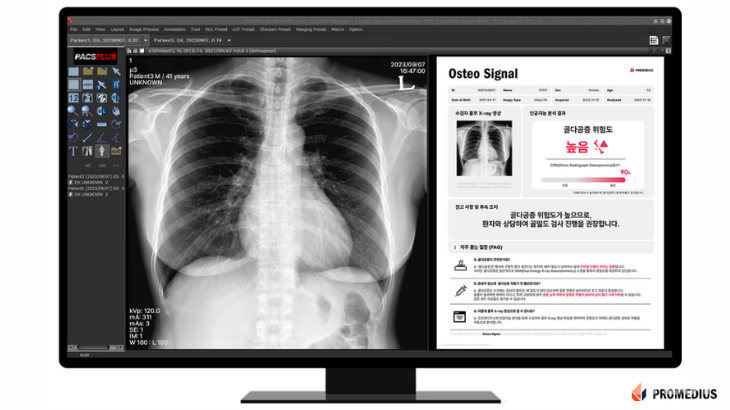 출처 = 프로메디우스